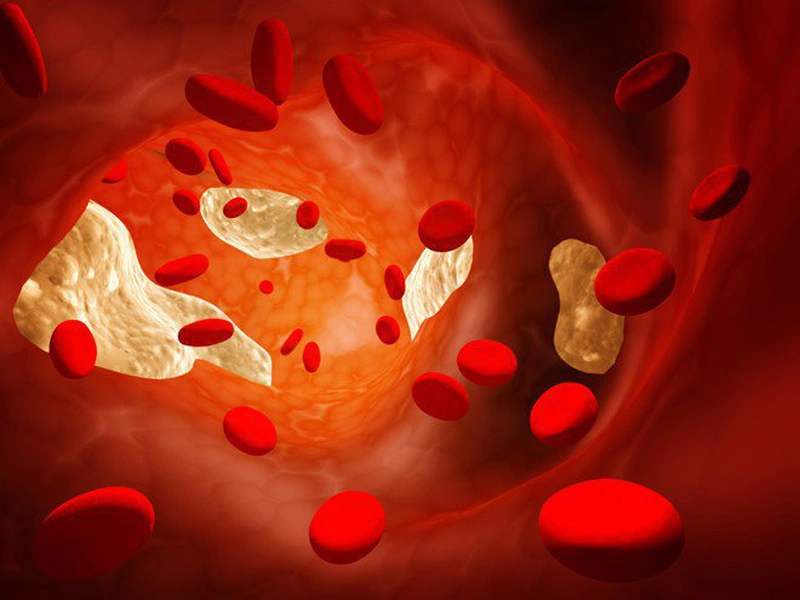 Các cách giúp bạn giảm cholesterol máu