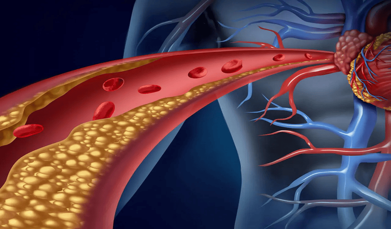 Cholesterol là gì? Biện pháp kiểm soát cholesterol trong máu